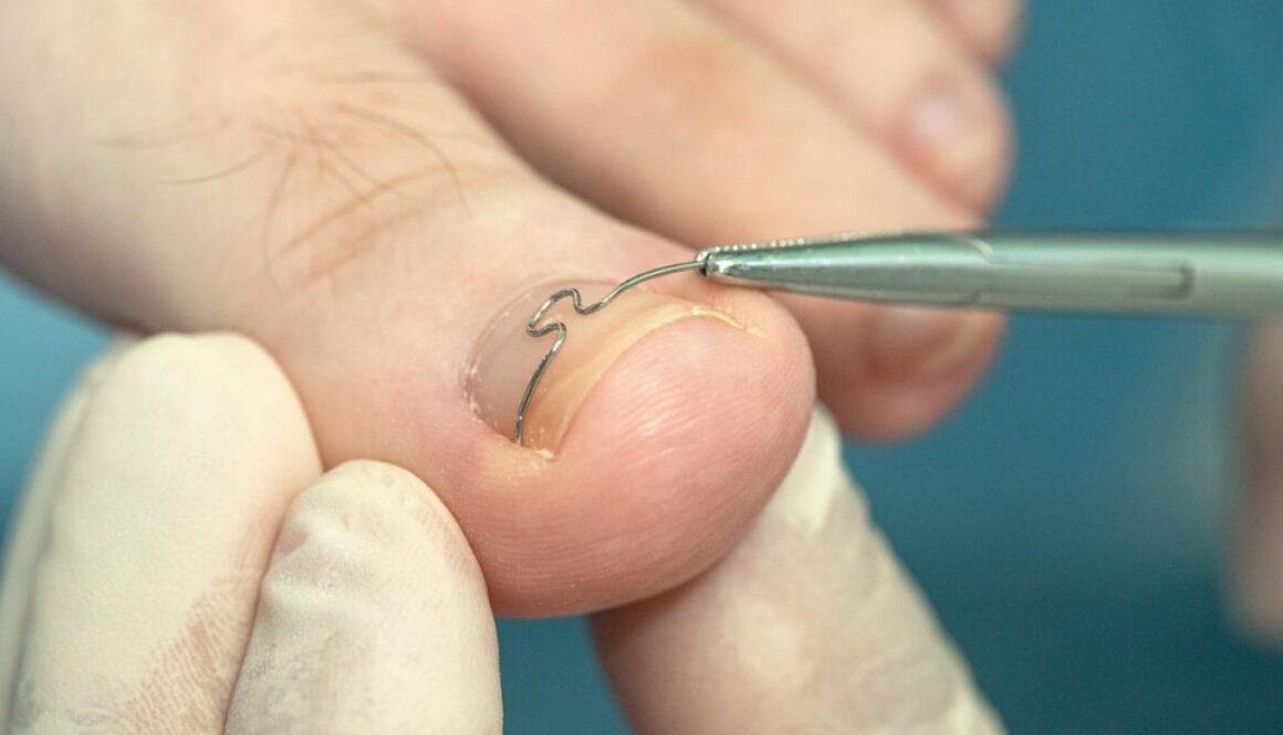 chiropodist preston