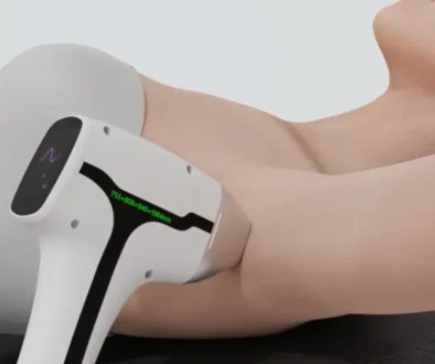 laser hair reduction in preston
